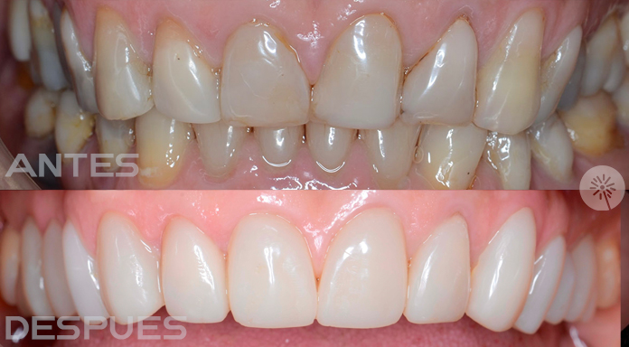 Rehabilitación Oral